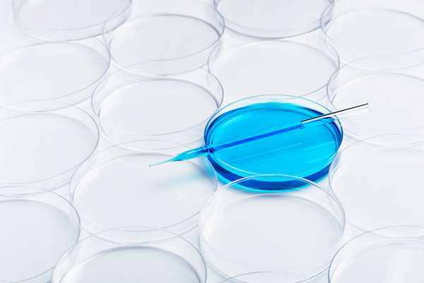 cultures de cellules bleues en laboratoire dans une boîte de Pétri